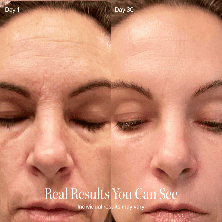SKNE 4-in-1 Skincare Wand